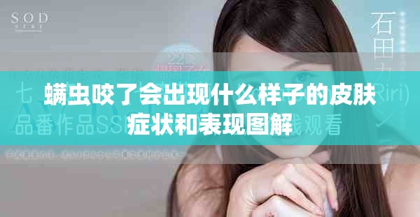 螨虫咬了会出现什么样子的皮肤症状和表现图解
